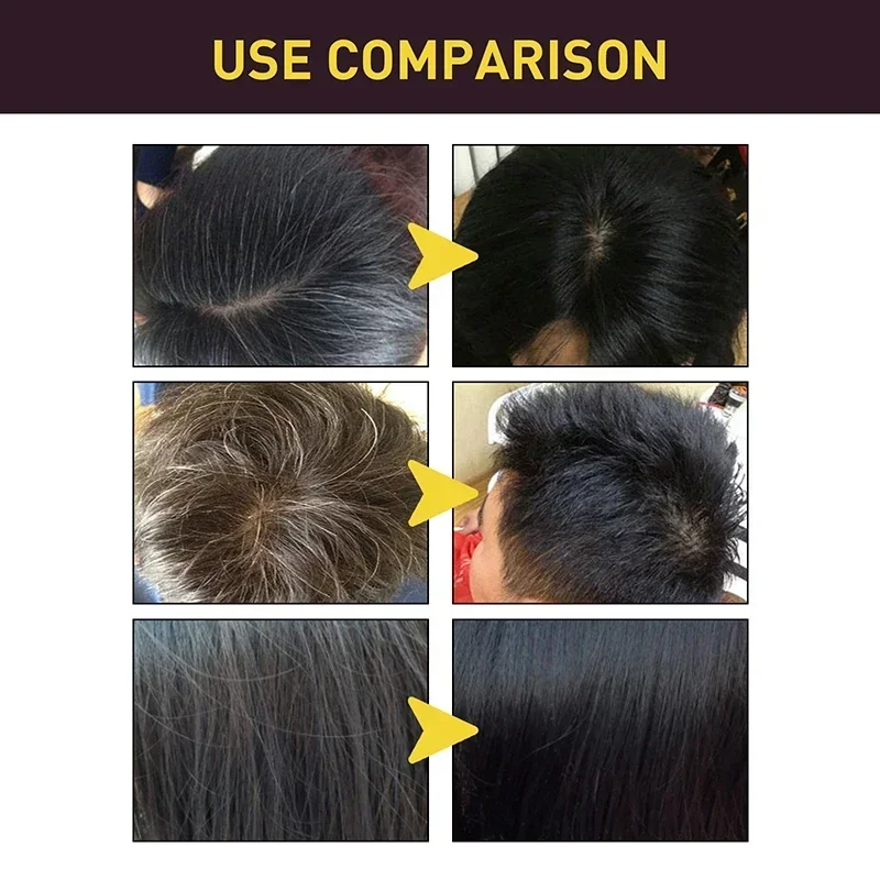Sampo mewarnai rambut warna hi - Hair Care Loreal ulasan dan harga
