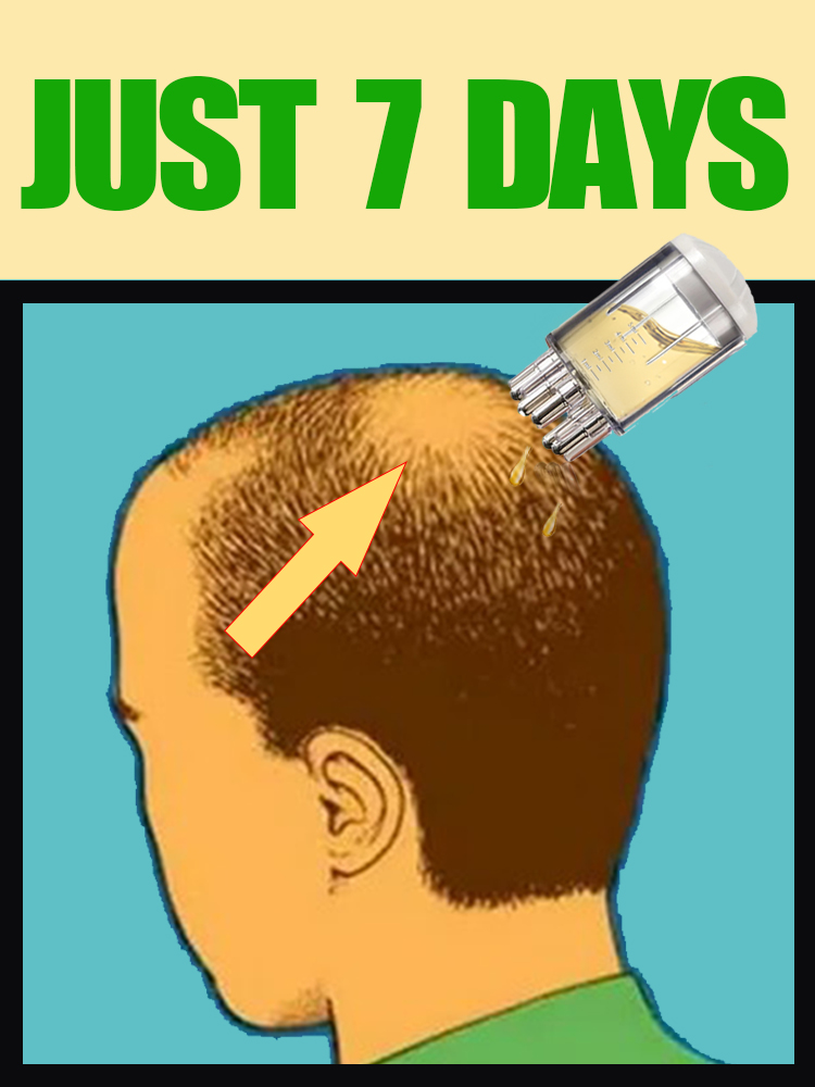 2025 PENINGKATAN TERBARU Sisir - Hair Care Oil Serum ulasan dan harga