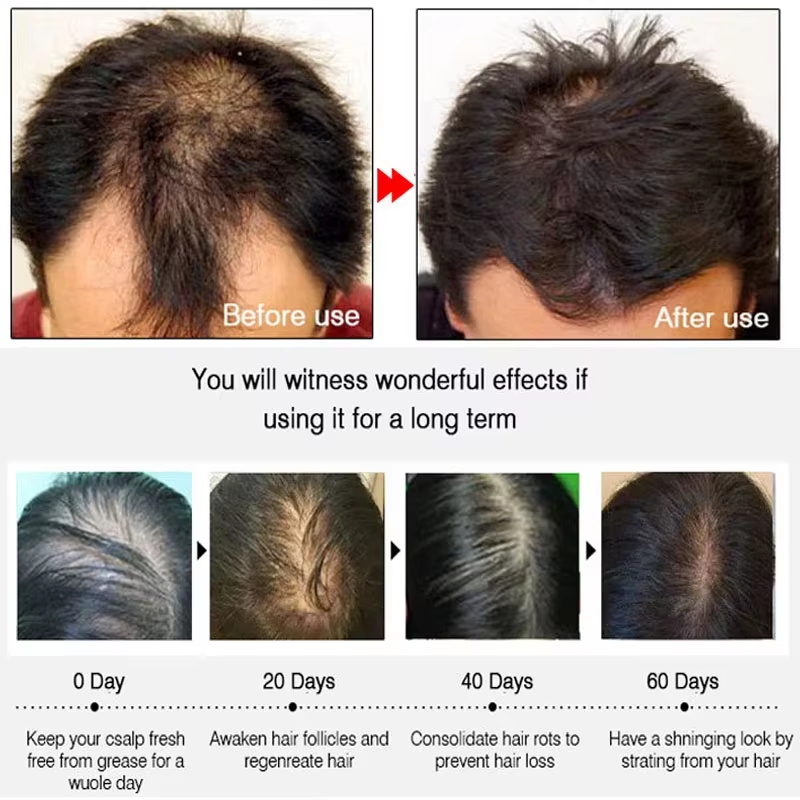 Semprotan Penumbuh Rambut Jahe - Hair Care Oil Serum ulasan dan harga